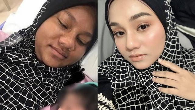 Viral Wajah Wanita Ini Mendadak Berubah saat Hamil